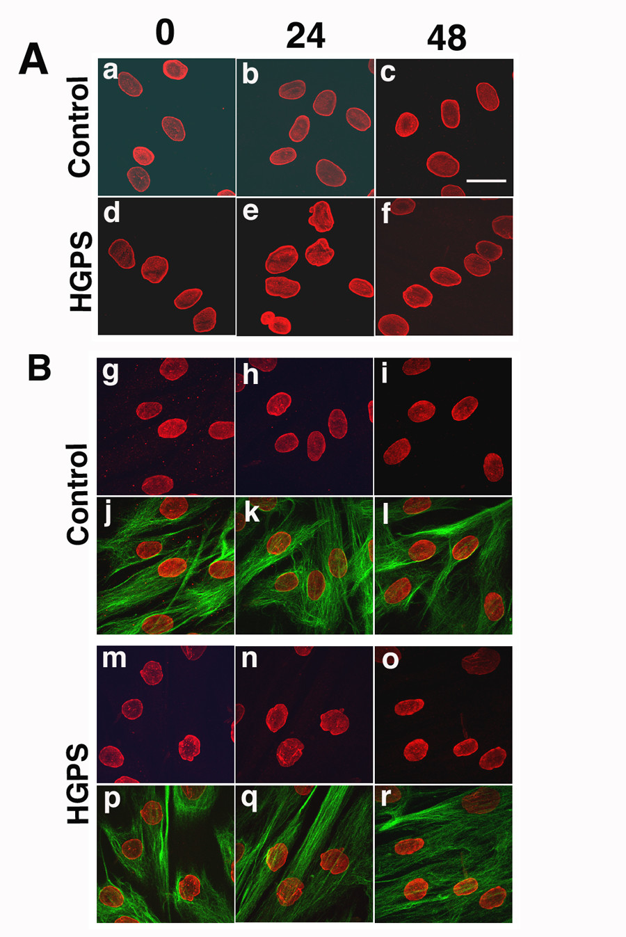 Dermal Fibroblast