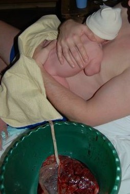 photo of newborn with intact umbilicus, one ho...