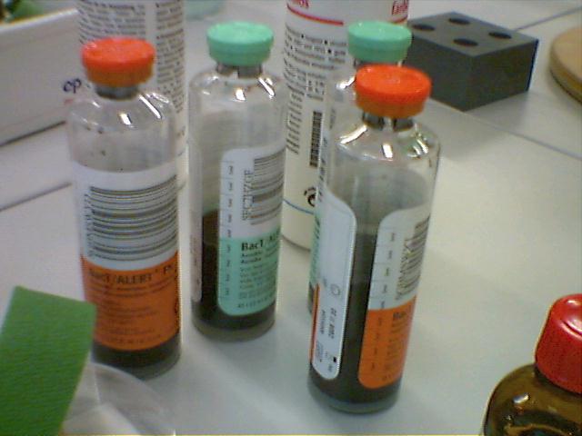 File:Blutkultur - blood culture.jpg