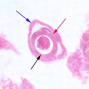 Bacillaire band (blauwe pijl), darm (rode pijl) en uterus met een ei in dwarsdoorsnede (zwarte pijl) bij Capillaria philippinensis