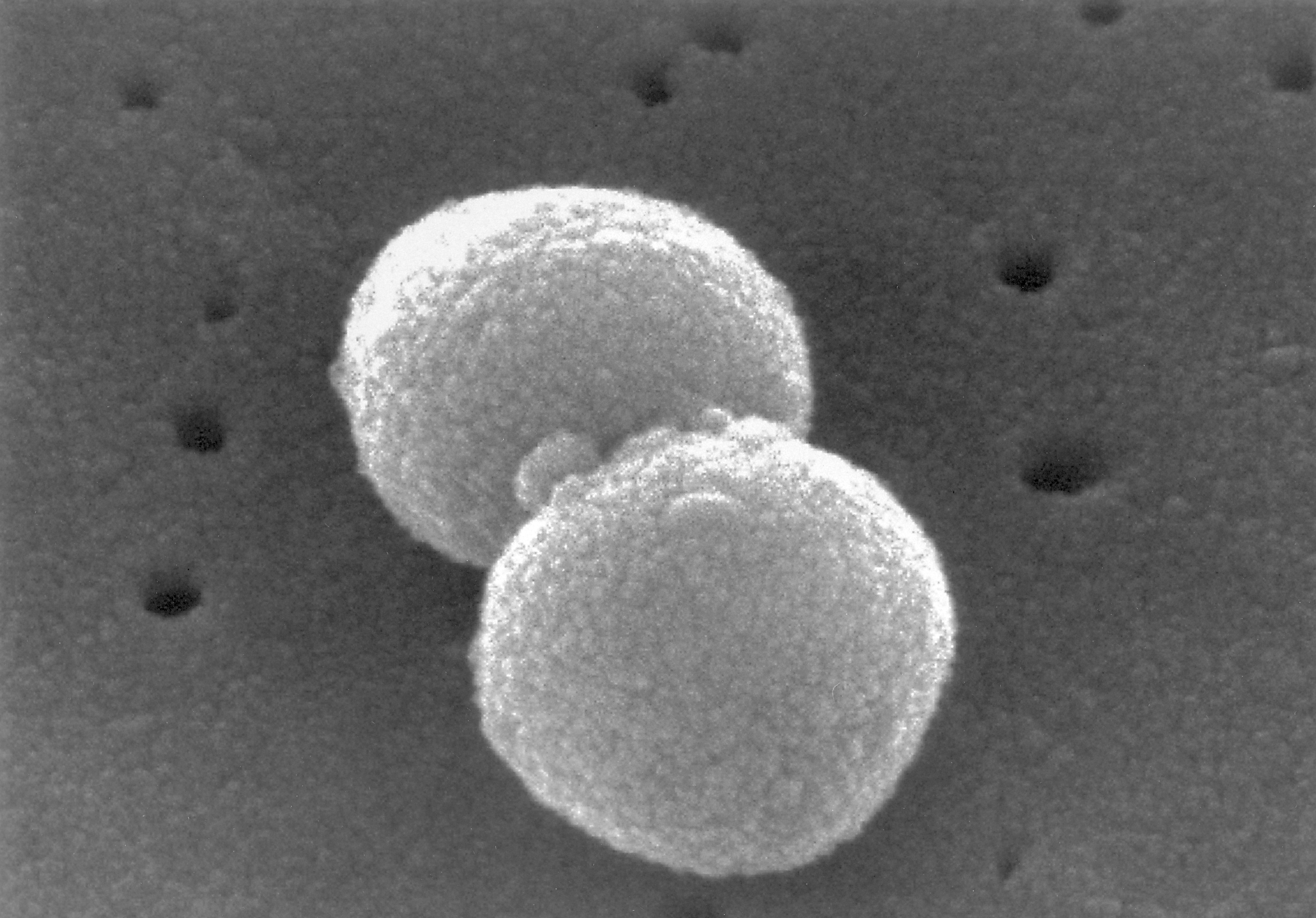 Streptococcus pneumoniae scanning electron microscpe