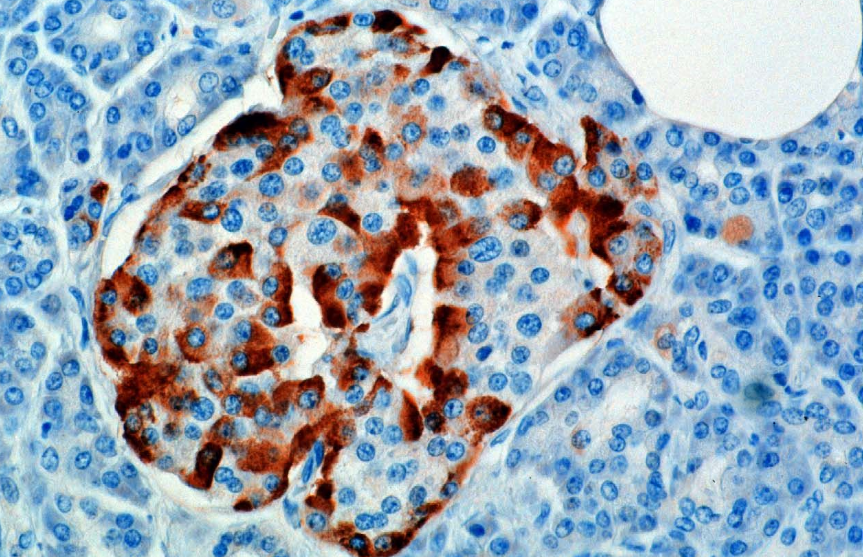 Een microscopisch beeld gekleurd voor glucagon