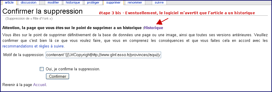 Suppression d'article avec historique