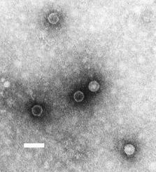 Micrografia TEM de viriões do poliovírus. Barra de escala, 50 nm.