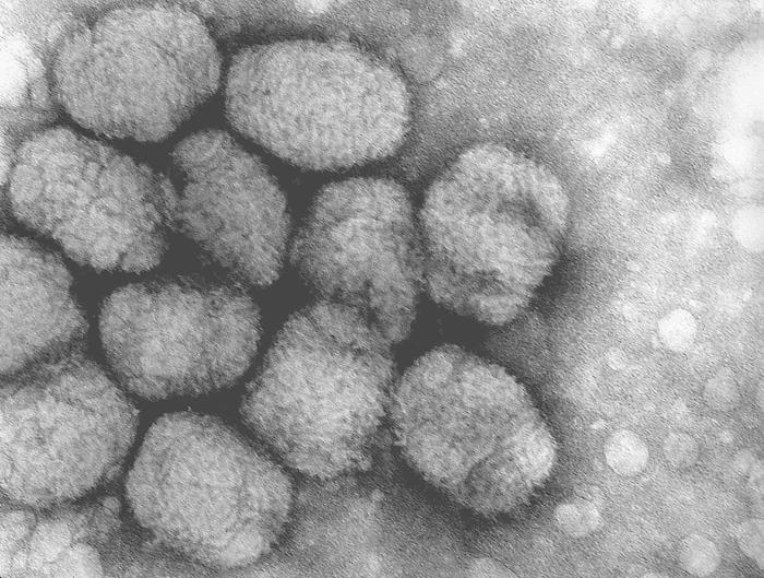 A transmission electron micrograph of smallpox viruses. Image from the CDC Public Health Image Library.