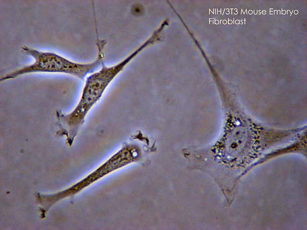 File:Fibroblast.jpg