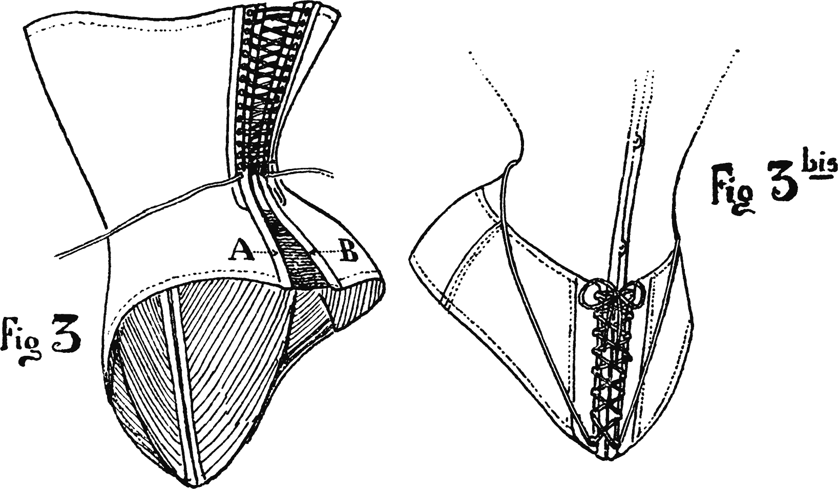 Drawing Of Corset