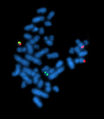 The Philadelphia chromosome as seen by metaphase FISH.