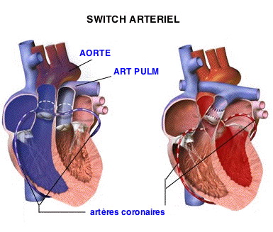 Korekcja anatomiczna wady