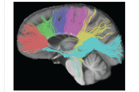 Fiber tracts from six segments of the corpus callosum.gif