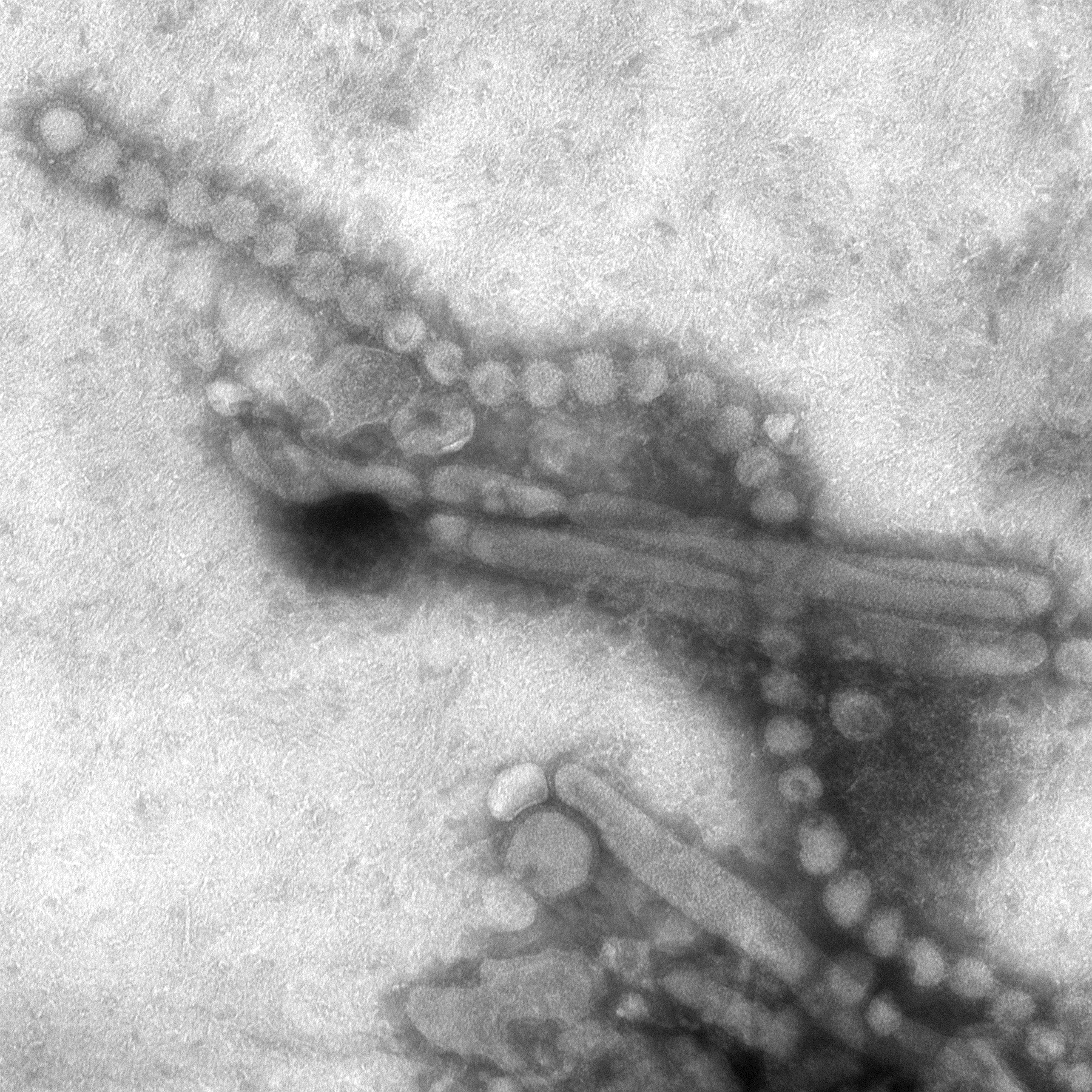 H7N9 influenza A avian