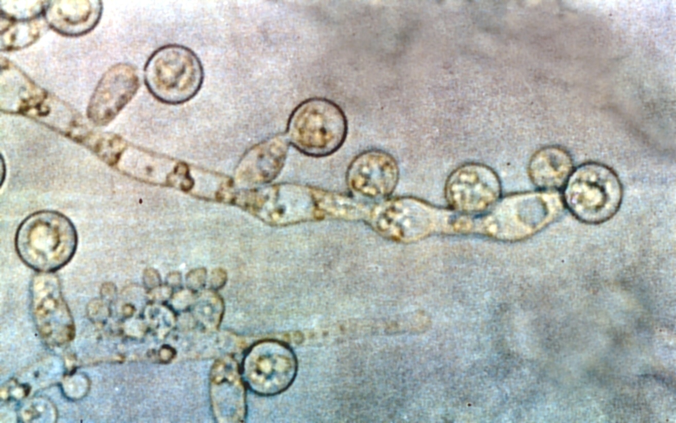 Description Candida albicans 2.jpg