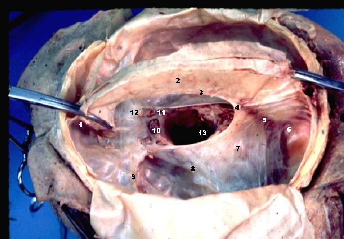 Dural Partitions