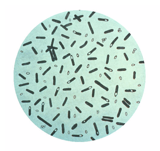 File:Clostridium botulinum.jpg