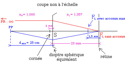 Coupe du modèle de Listing [9] d'un œil emmétrope avec position '"`UNIQ--postMath-00000043-QINU`"'en rouge'"`UNIQ--postMath-00000044-QINU`"' de son foyer principal image sans accommodation associée à son PR et position '"`UNIQ--postMath-00000045-QINU`"'en bleu'"`UNIQ--postMath-00000046-QINU`"' de son foyer principal image avec accommodation maximale associée à son PP