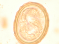 Ձվի մեջ զարգացող Ascaris lumbricoides-ի թրթուրային ձևը