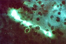 Na obrázku je bakterie Chlamydophila psittaci, která parazituje na kondorovi krocanovitém..