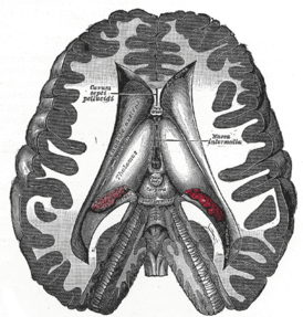 Разрез, показывающий желудочки мозга. Межталамическое сращение показано как massa intermedia в центре справа.