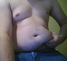 Excess Visceral Fat Symptoms