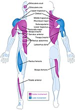 Miniatura para Distrofia muscular facioescapulohumeral