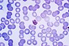 Mature Plasmodium malariae schizont PHIL 2715 lores.jpg