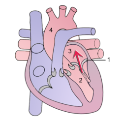قلس تاجي (رسم توضيحي) أثناء انقباض البطين الأيسر, برجع الدم مرة أخرى بشكل غير طبيعي إلى الأذين الأيسر (مع السهم). # الصمام التاجي # البطين الأيسر # الأذين الأيسر # الأبهر