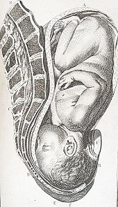An illustration of normal head-first presentation by the obstetrician William Smellie from about 1792. The membranes have ruptured and the cervix is fully dilated. Cephalicpre.JPG