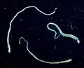 Zwergbandwurm (Hymenolepis nana)
