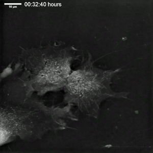 Een voorbeeld van menselijke mesenchymatische stamcellen onder een live cell imaging microscoop