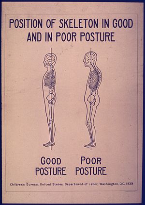 POSITION OF SKELETON IN GOOD AND POOR POSTURE ...