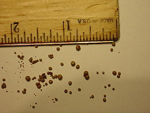 Urate stones removed from a dog's urinary bladder.