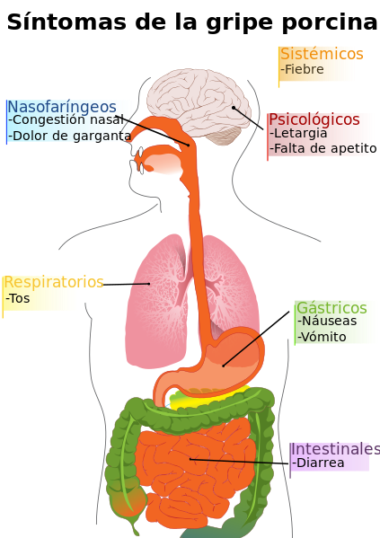 Archivo:Diagram of swine flu symptoms-es.svg