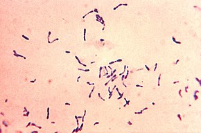 Corynebacterium diphtheriae, збудник дифтерії