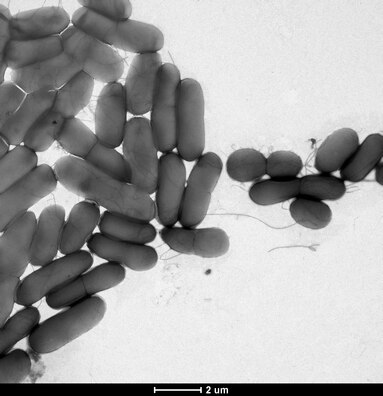 Transmission electron micrograph showing bacteria Escherichia coli that form extensive biofilms using a network of conjugative F-pili. Source: Jonasz Patkowski Escherichia coli forming biofilms via F-pilus.tif