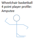 Potential amputation profile of a person in this class and their related wheelchair basketball classification