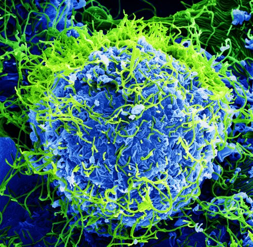 International runner-up U.S. Jury's Choice Award Beautiful... But Deadly by BernbaumJG. A colorized scanning electron micrograph of Ebola virus particles (green), found both as extracellular particles and budding particles from a chronically-infected African green monkey kidney cell (blue), at 20,000x magnification.