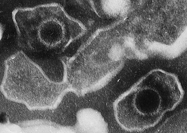 Electron micrograph of two Epstein–Barr virus particles