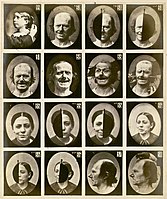 Facial expressions triggered by electric stimulation. From Mécanisme de la Physionomie Humaine by Guillaume Duchenne (1862), who is also credited with the discovery Duchenne muscular dystrophy yet was never elected to the French Academy of Sciences.