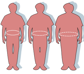 Three silhouettes depicting the outlines of a normal sized (left), overweight (middle), and obese person (right).