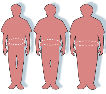 English: Illustration of obesity and waist cir...