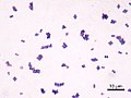 Staphylococcus aureus onder een microscoop