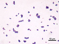 Staphylococcus aureus farvet efter Gram-metoden.