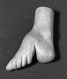 Cast of women's foot deformed by foot binding Cast of women's foot deformed by foot binding Wellcome L0005105.jpg