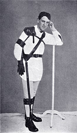 Photographie en noir et blanc d'un homme debout muni d'un appareillage orthopédique complexe, prenant la jambe droite.