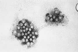 Noroviren im elektronen­mikroskopischen Bild