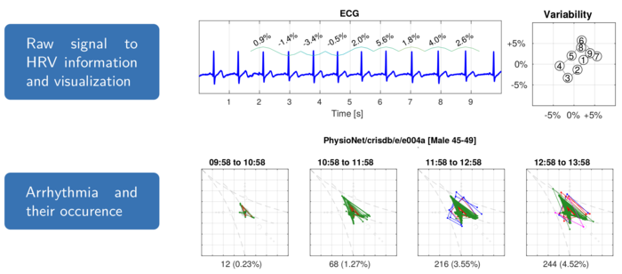 Das Bild zeigt ein herkömmliches EKG mit der prozentualen Änderung (relatives RR Intervall nach Marcus Vollmer) der Intervalle zwischen den Herzschlägen. Auf der rechten Seite diese Variabilität als Streudiagramm dargestellt. Unten sieht man die die Darstellung des Streudiagramms zur Identifizierung von Arrhythmien und die Änderung des Typus und Häufigkeit anhand eines Datensatzes von PhysioNet (crisdb).