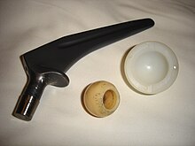 A titanium hip prosthesis, with a ceramic head and polyethylene acetabular cup. Hip prosthesis.jpg