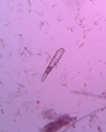 Demodex canis