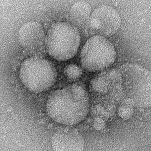 3D изображение коронавируса ближневосточного респираторного синдрома (MERS-CoV)