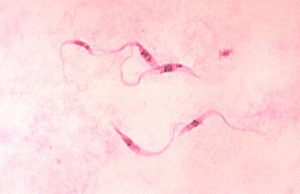 Photomicrograph of Giemsa-stained Trypanosoma cruzi